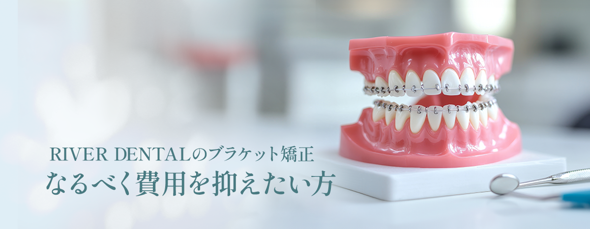 RIVER DENTALのブラケット矯正 なるべく費用を抑えたい方