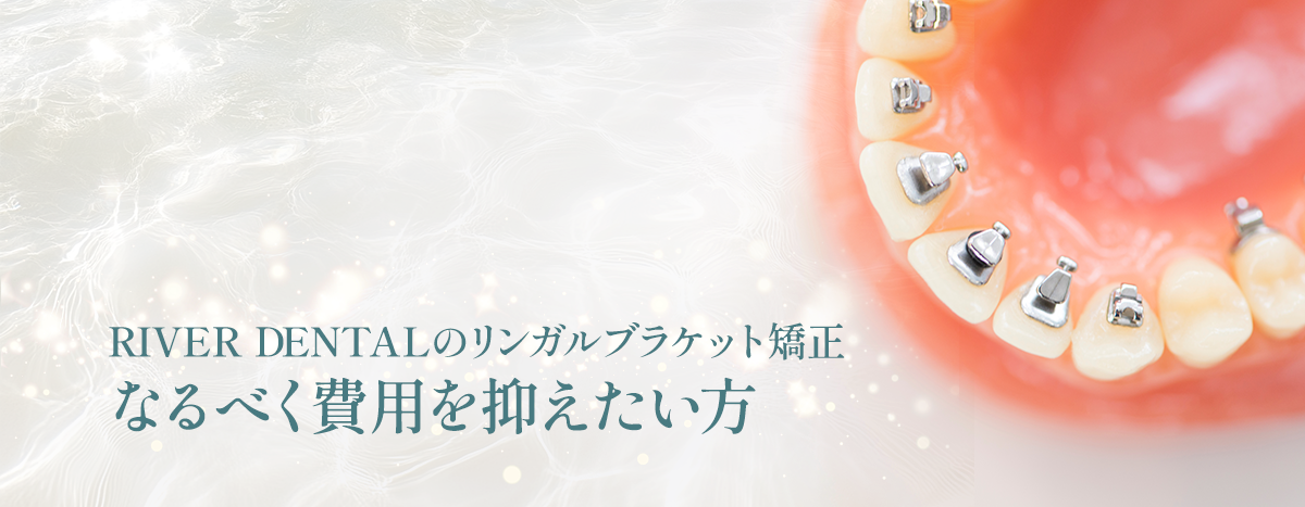 RIVER DENTALのリンガルブラケット矯正 なるべく費用を抑えたい方