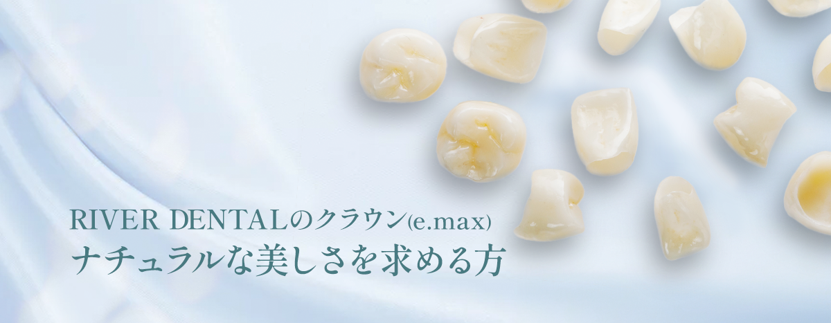 RIVER DENTALのクラウン(e.max) ナチュラルな美しさを求める方