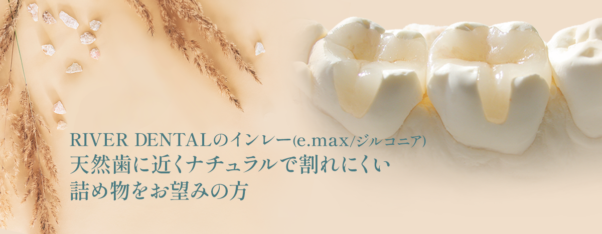 RIVER DENTALのインレー（e.max /ジルコニア） 天然歯に近くナチュラルで割れにくい詰め物をお望みの方