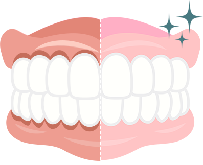 ガムピーリングとは