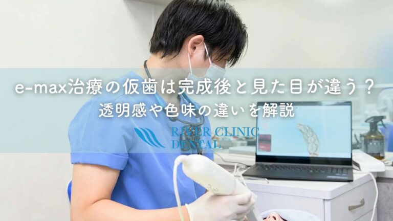 e-max治療の仮歯は完成後と見た目が違う？透明感や色味の違いを解説