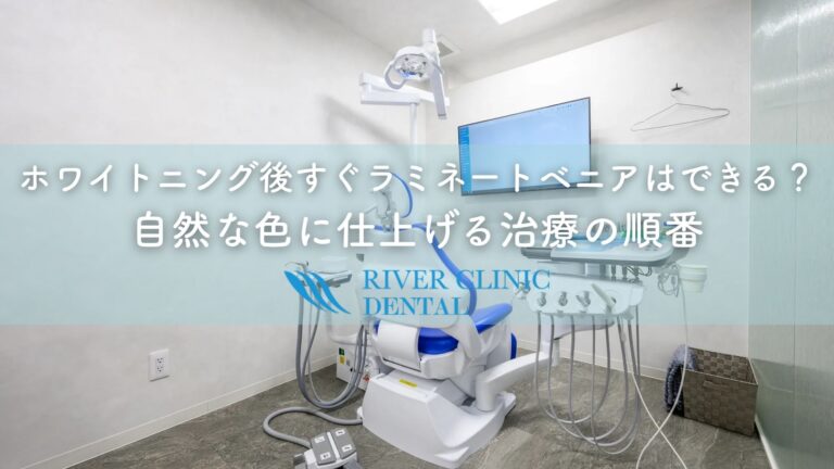 ホワイトニング後すぐラミネートベニアはできる？自然な色に仕上げる治療の順番
