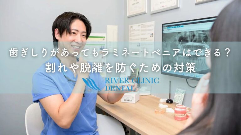 歯ぎしりがあってもラミネートベニアはできる？割れや脱離を防ぐための対策