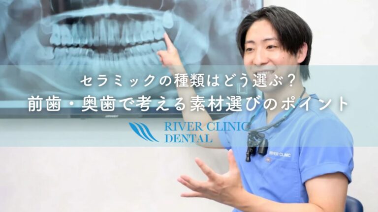 セラミックの種類はどう選ぶ？前歯・奥歯で考える素材選びのポイント