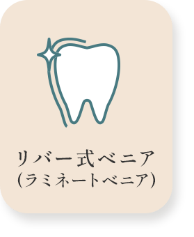 リバー式ベニア(ラミネートベニア)